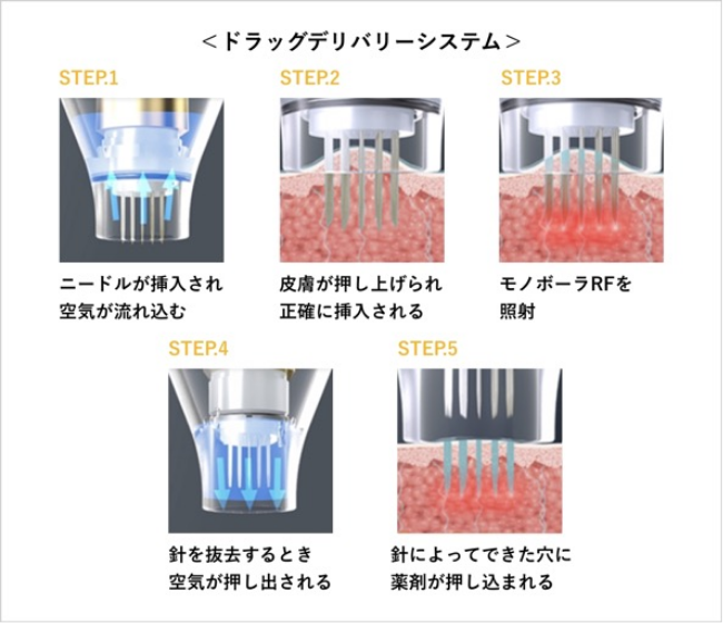 ドラッグデリバリーシステム