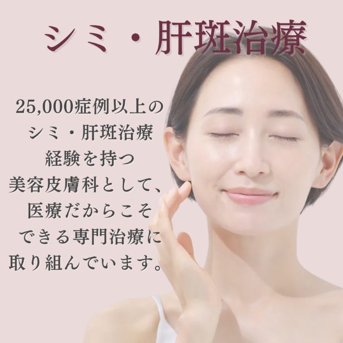 シミ・肝斑治療