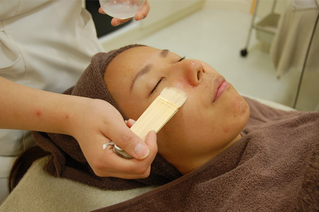 ケミカルピーリング