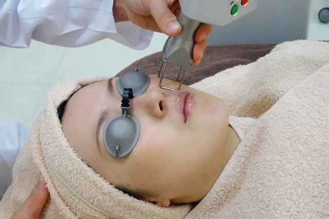 フラクショナル炭酸ガスレーザー～マドンナリフト～