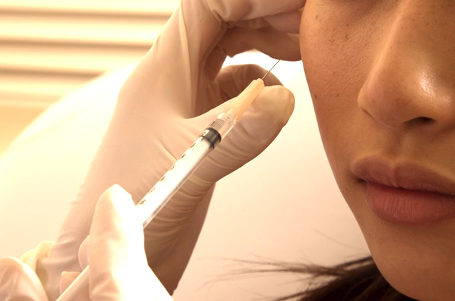 WOVE小じわ消し注射