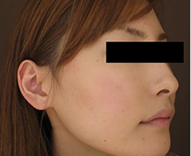 一見シミのないキレイなお肌