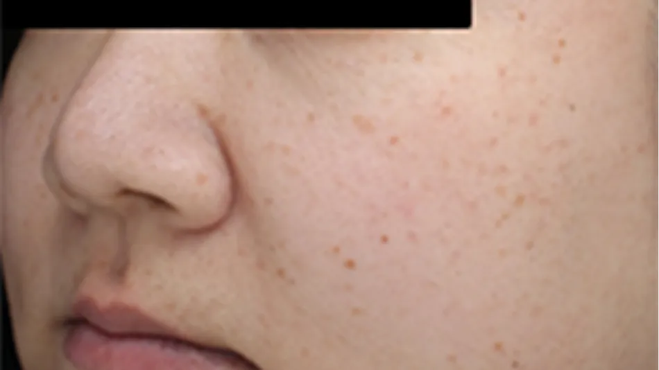 解析を基にした未来の肌