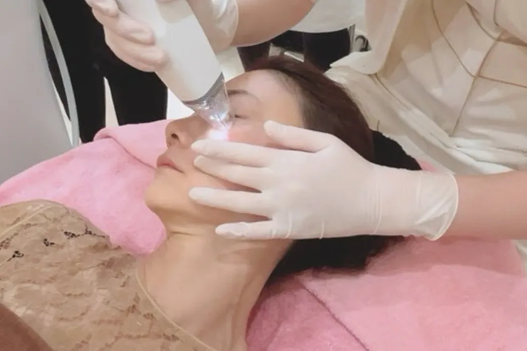 肝斑ポテンツァ