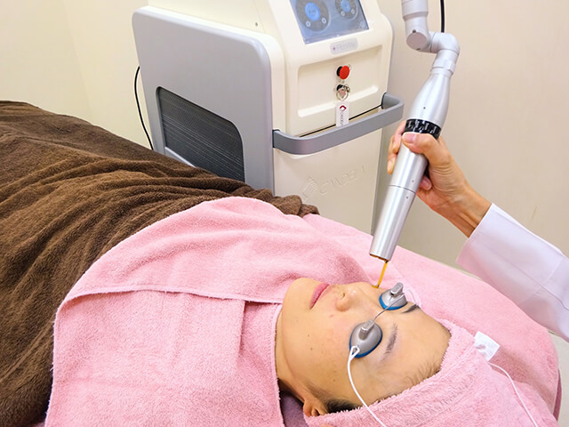 シミ取りレーザーの副作用とは?痛みはある?